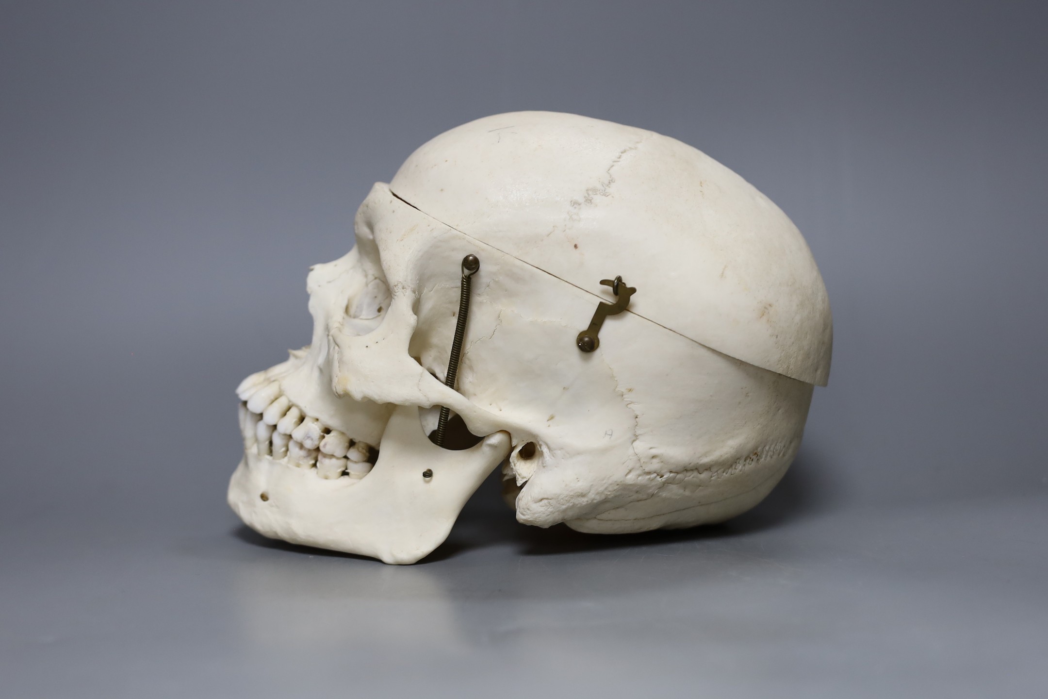 A human skull, 21 cms wide